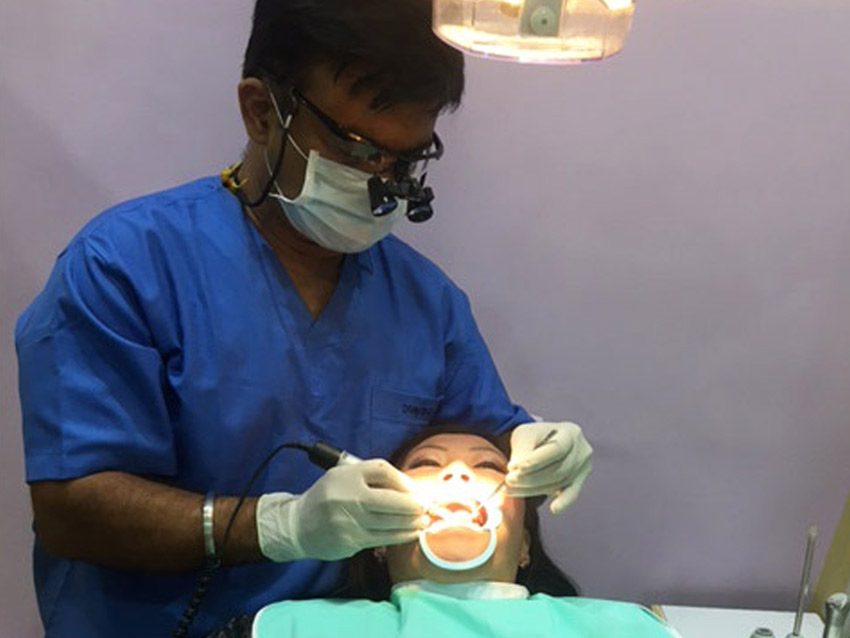 dental veneers in hyderabad