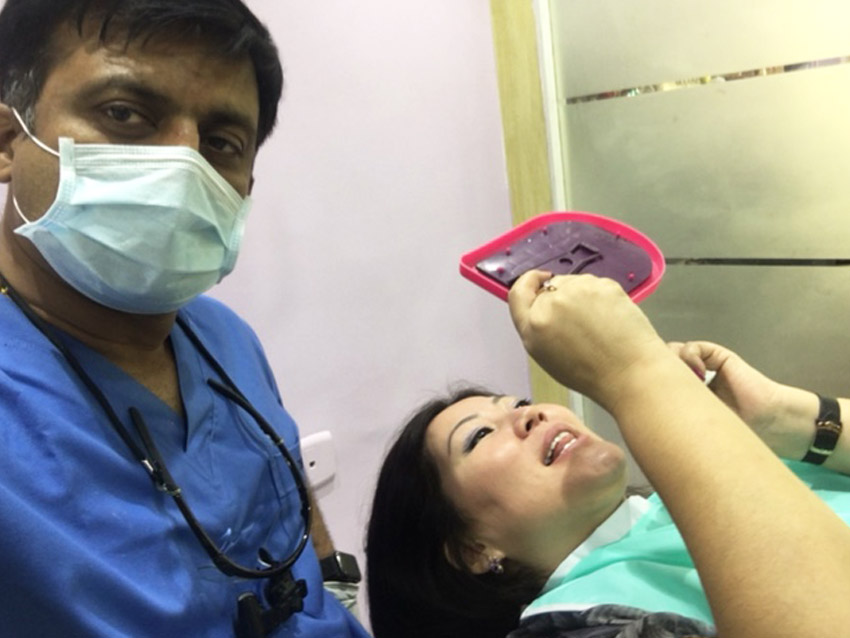 Dental Implants In Hyderabad