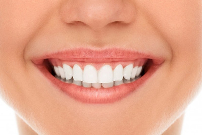 Teeth Whitening Dentist In Ameerpet