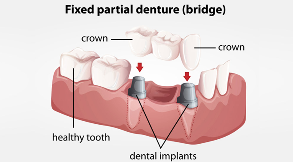 Dental Clinic In Erragada