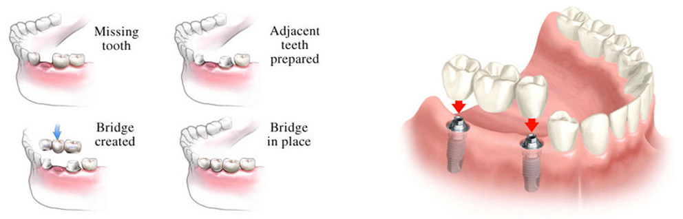 Dental Clinic In Sanath Nagar