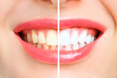 best dental clinic in Ameerpet